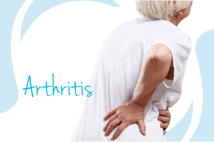 Arthritis